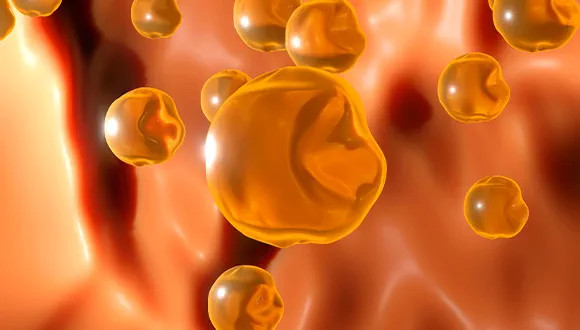 Apo A-I (Apolipoprotein A-I)